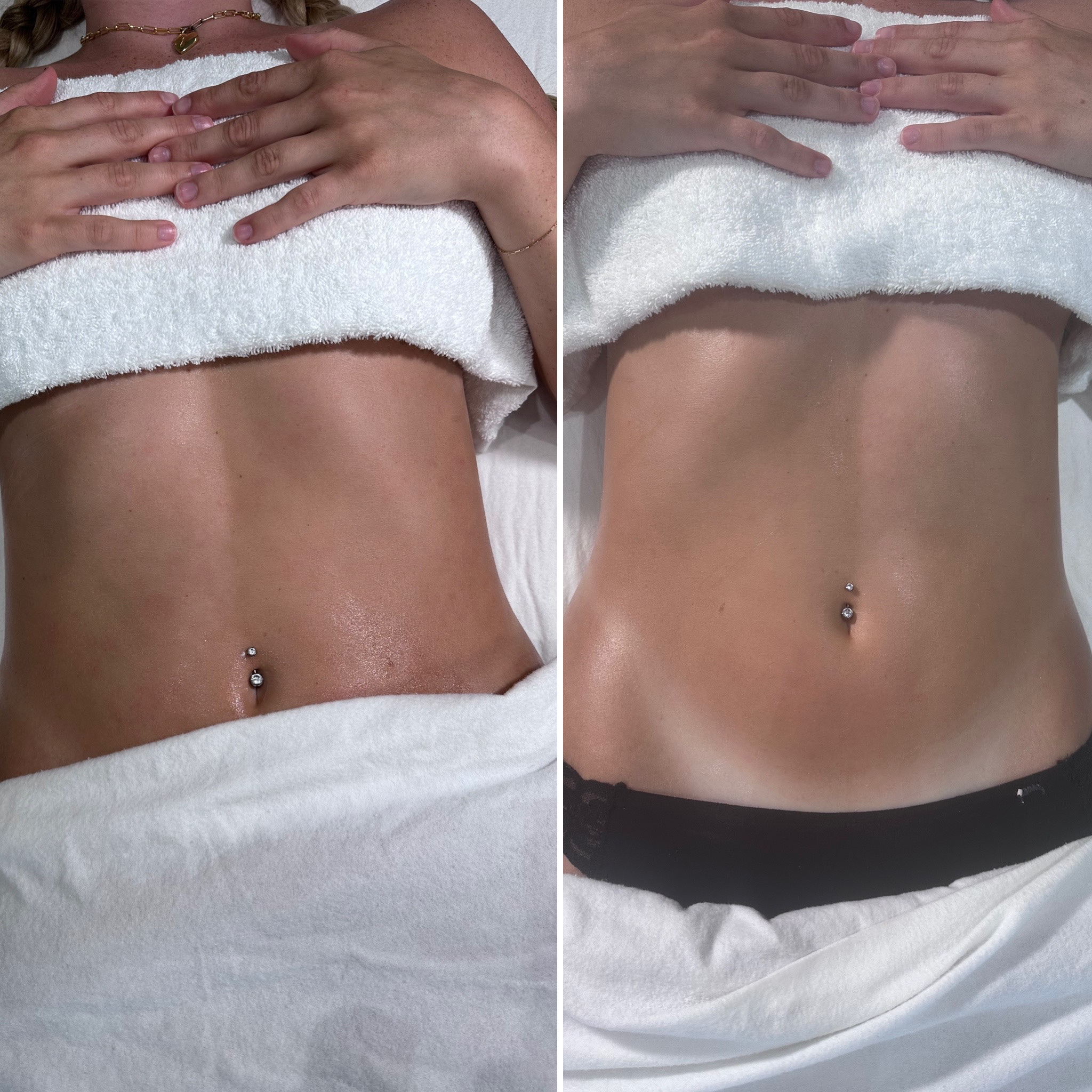 Brazilian Lymph Spa In Chicago IL - Styles | Vagaro