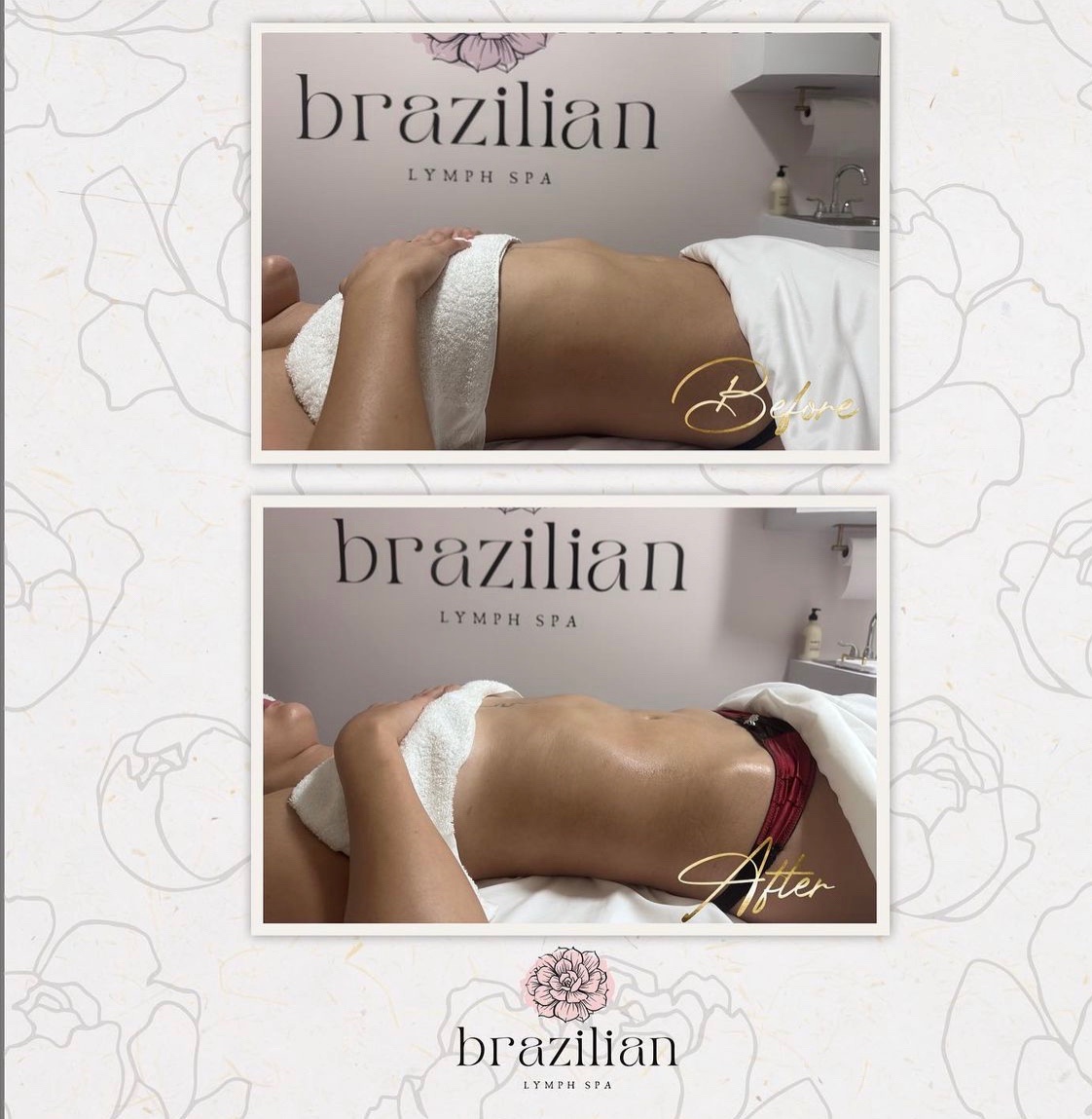 Brazilian Lymph Spa In Chicago IL - Styles | Vagaro